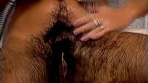 Hairy Hirsute